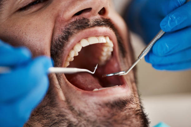 Best Teeth Whitening  in North Yelm, WA